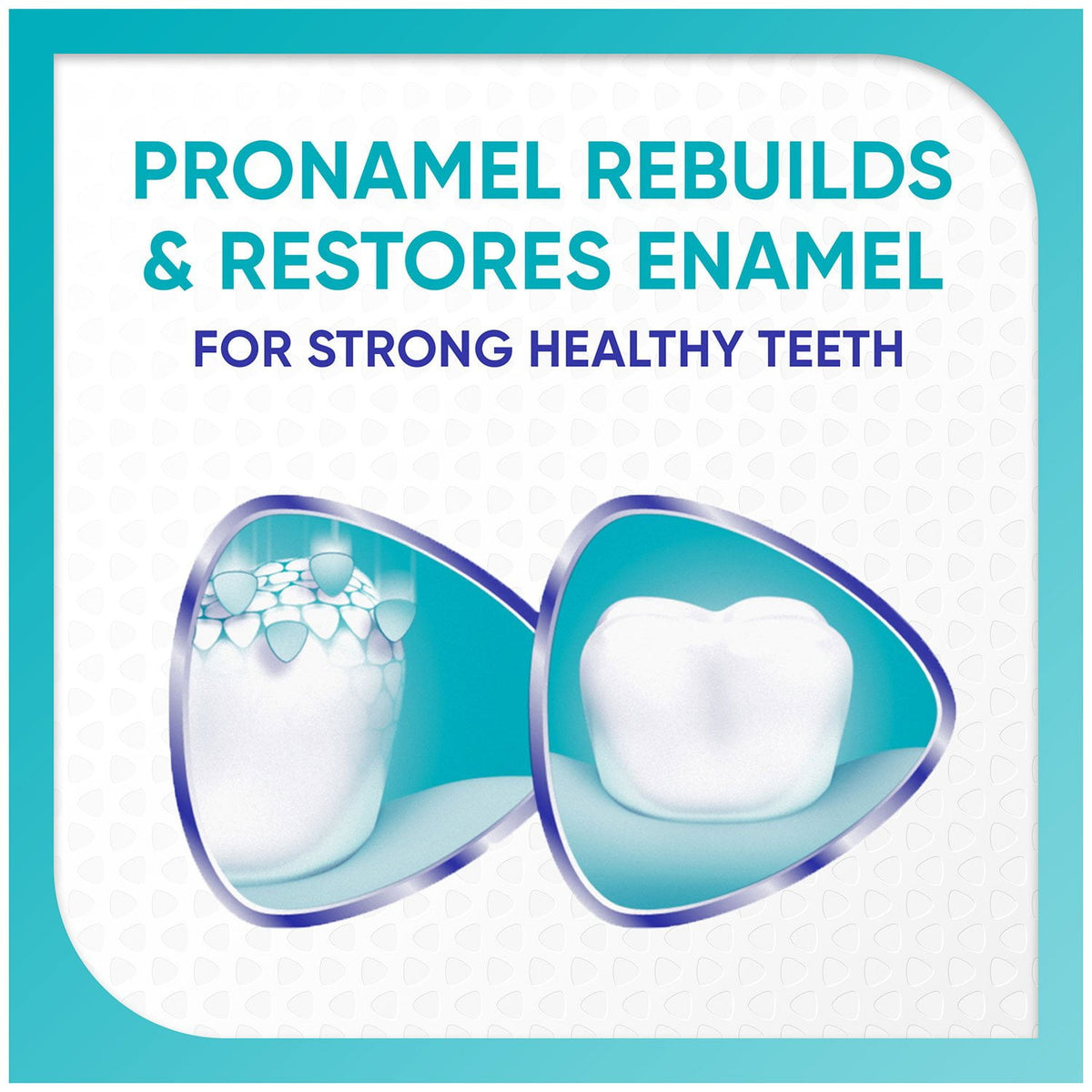 Sensodyne Pronamel Advanced Whitening Toothpaste, 6.5 oz., 4 pk.
