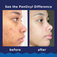 PanOxyl Acne Foaming Wash, 10% Benzoyl Peroxide, 5.5 oz., 2 pk.